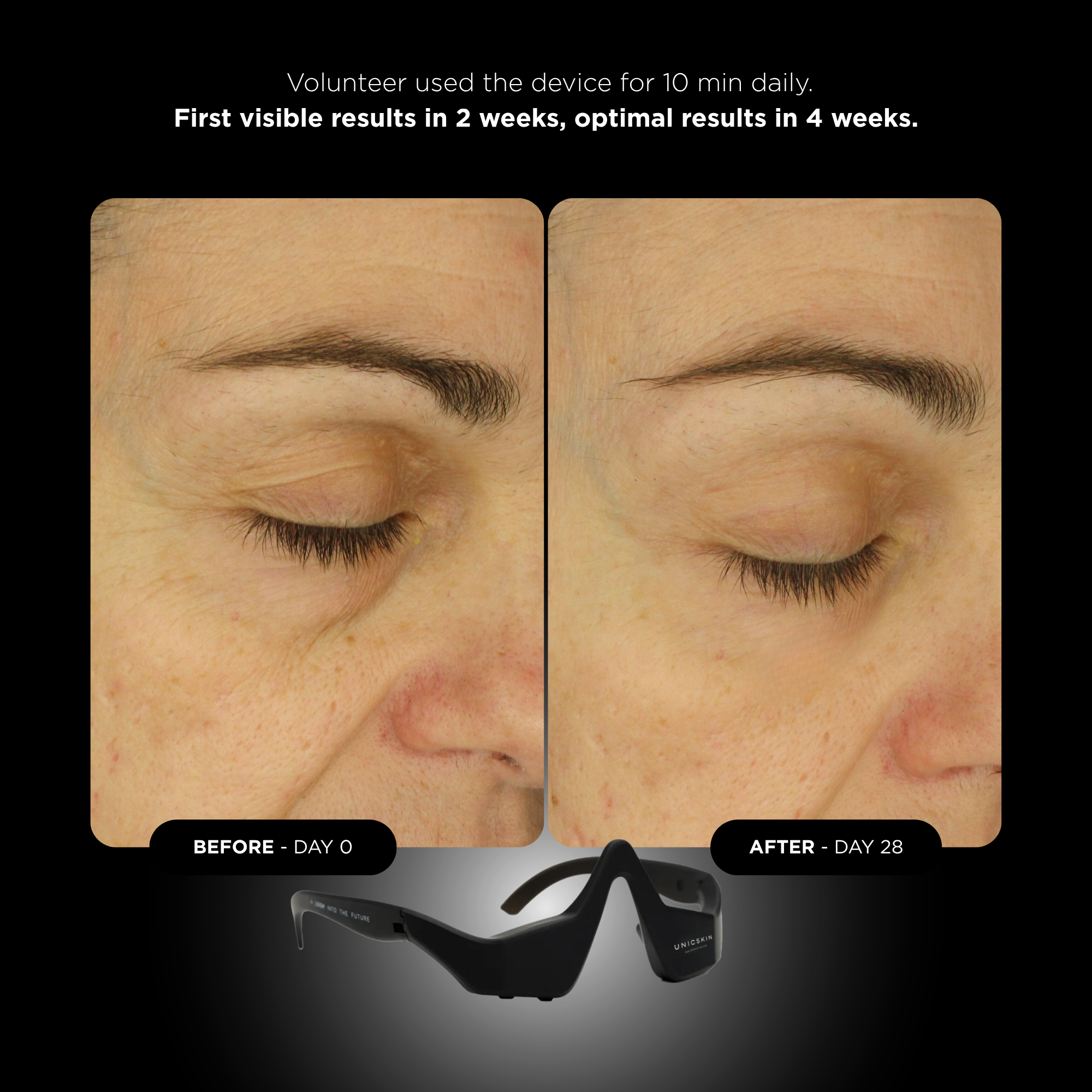 UNICTECH EYE MASK