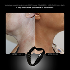 UNICLED NECK & CHIN MASK 5.0