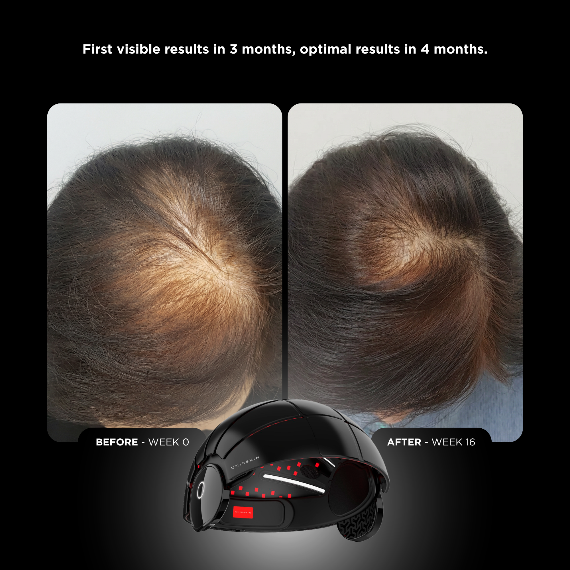 UNICLED HELMET 5.0 OMEGA