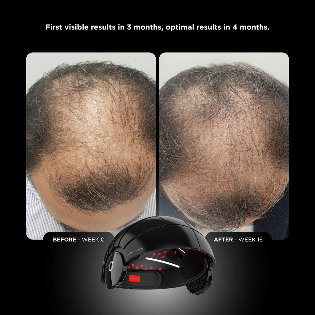 UNICLED HELMET 5.0 OMEGA